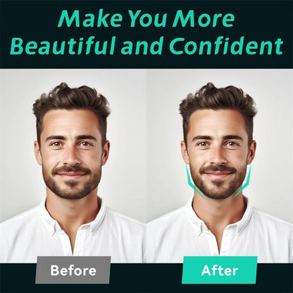 6x Entraîneur de mâchoire en silicone